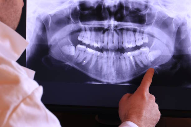 Best Emergency Dental Surgery in Owensboro, KY