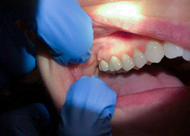 Best Emergency Treatment for Toothache in Owensboro, KY