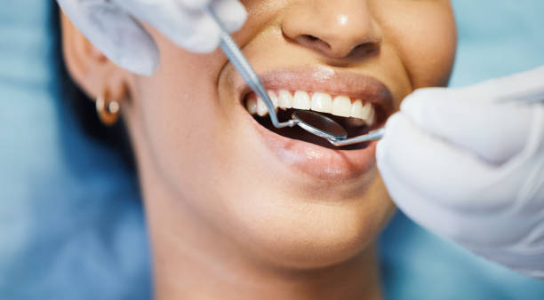 Best Emergency Tooth Extraction in Owensboro, KY
